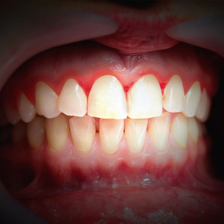 Periodontoloji